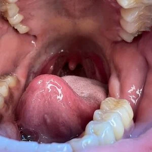 n3edymouth