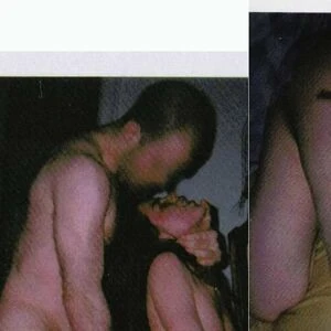 Nausea