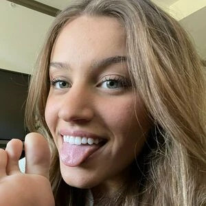 herathletefeetxo