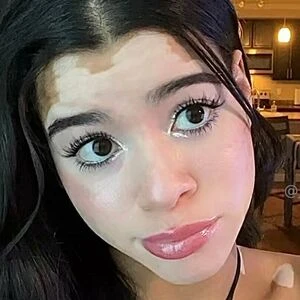 jade2skinzz