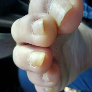 missfeetstink